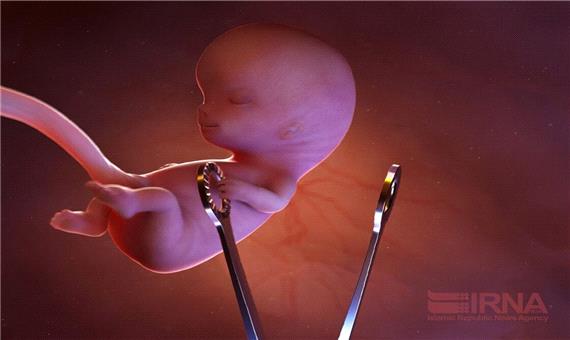 ابعاد فقهی سقط جنین و پیشنهادات قانونی