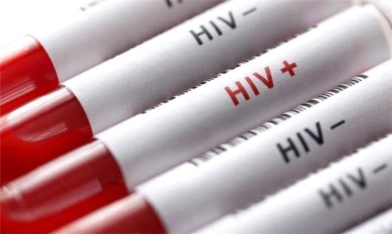 روابط جنسی بیشترین علت بروز HIV در 1401