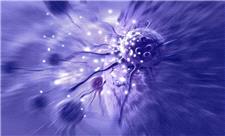 کشف روشی برای حمله به سلول‌های سرطانی