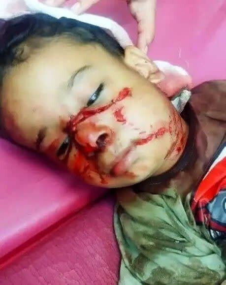 حمله سگ‌های ولگرد به کودک ۴ ساله در شوش