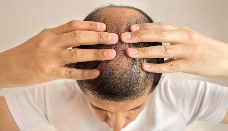 این داروی درمان ریزش مو باعث ایجاد افکار خودکشی می‌شود