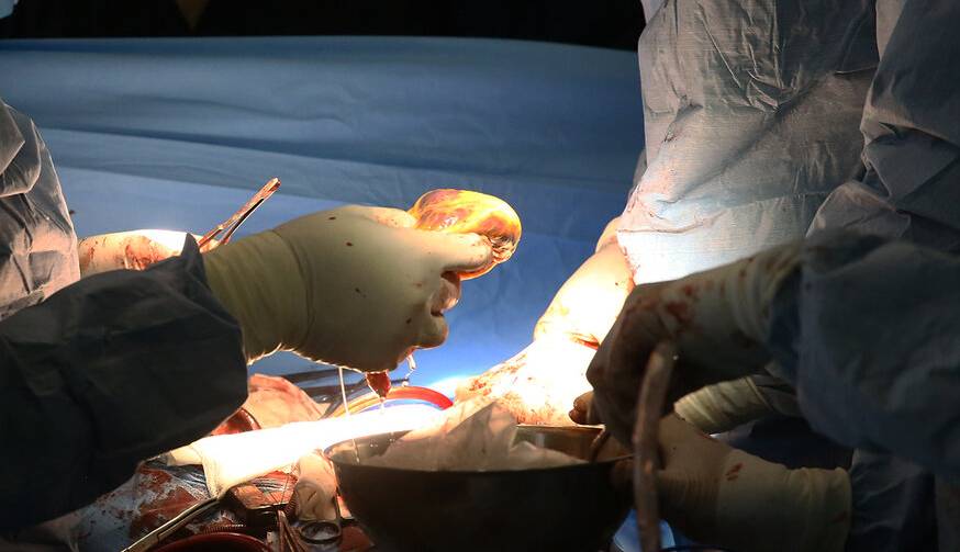 نوجوان ۱۸ ساله مرگ مغزی جان چهار نفر را نجات داد