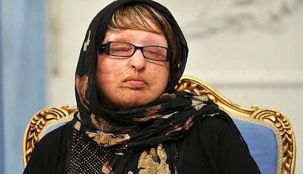 تلاش ۱۴ ساله آمنه بهرامی برای دریافت دیه چشمانش