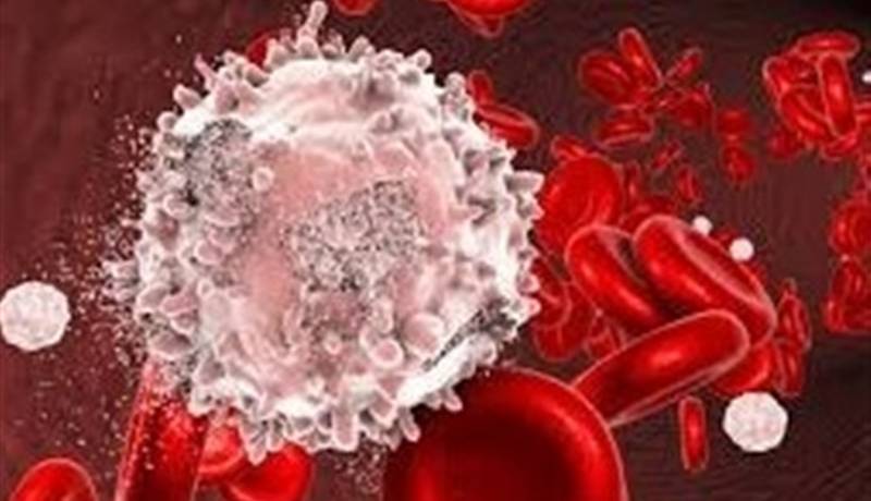 تولید یکی از پیچیده‌ترین داروهای سرطان خون در ایران