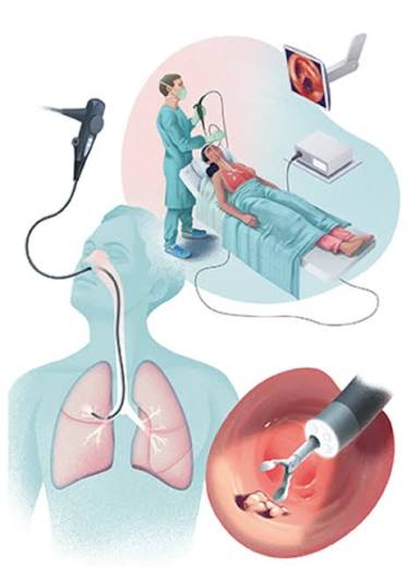 معنای واژه «اسکوپی» در علم پزشکی چیست؟