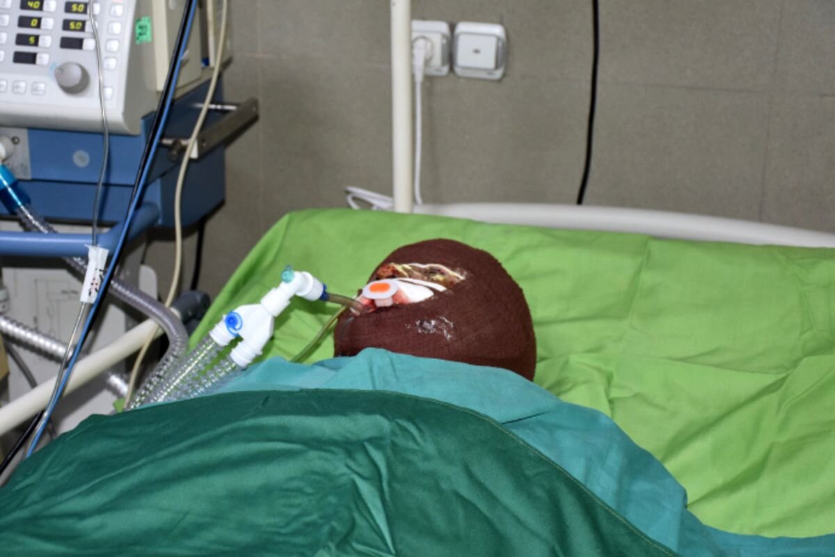 اسیدپاشی هولناک روی پدر و دختر نوجوان