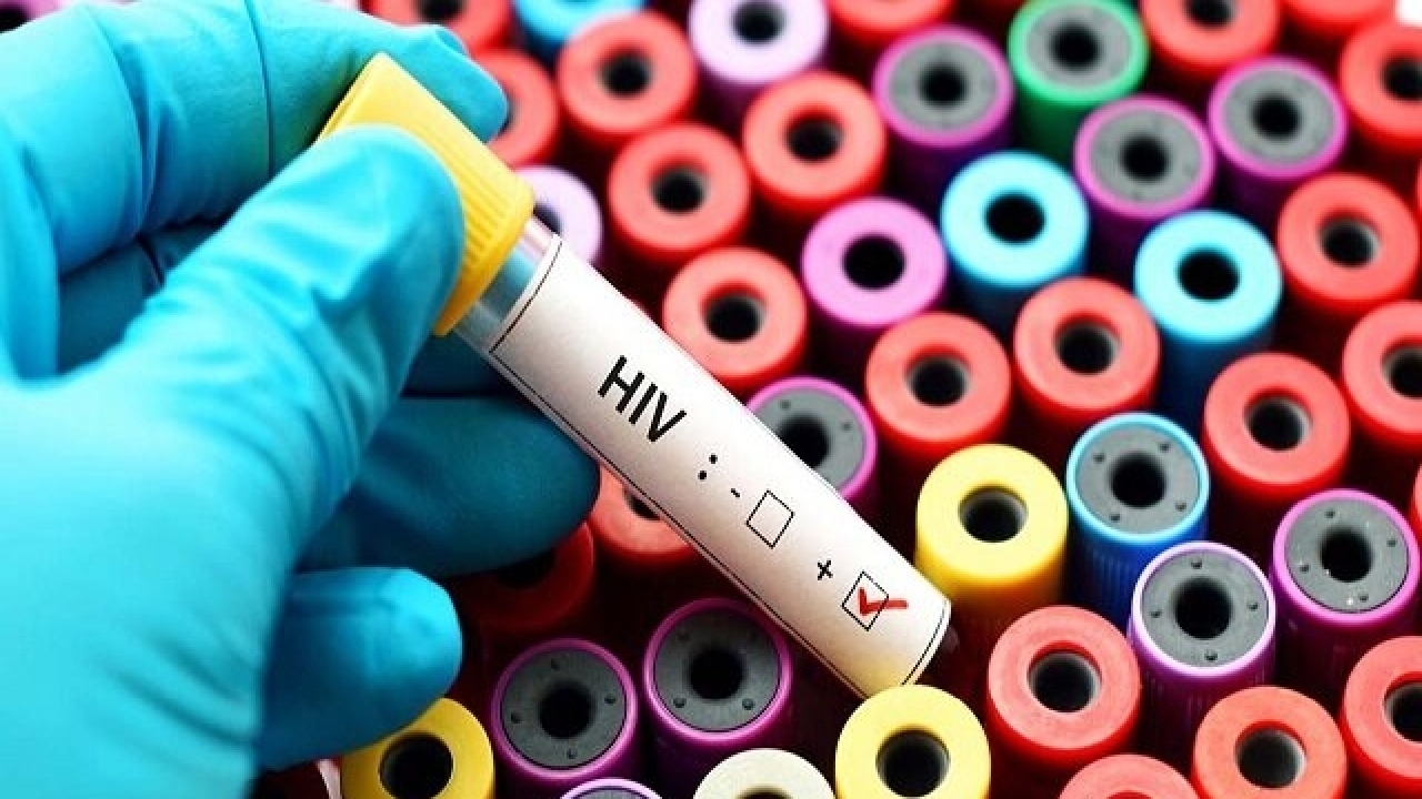 آمار هولناک ابتلا به ویروس HIV در کشور
