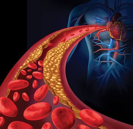 چربی خون هیچ علامتی ندارد!