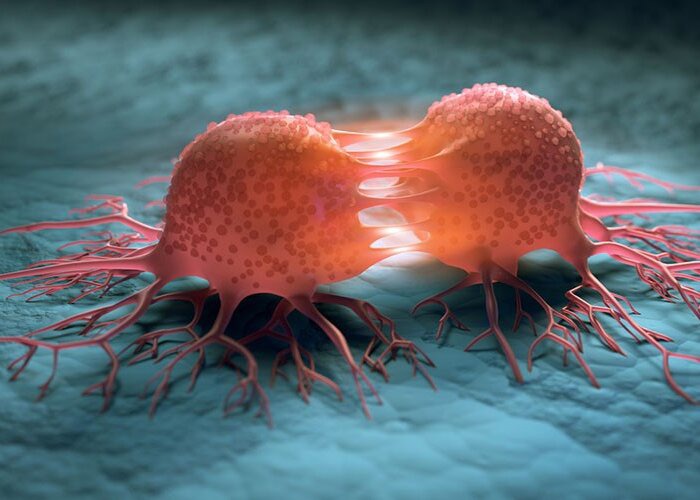 غربالگری سرطان برای شناسایی و درمان زودهنگام بیماری ضروری است