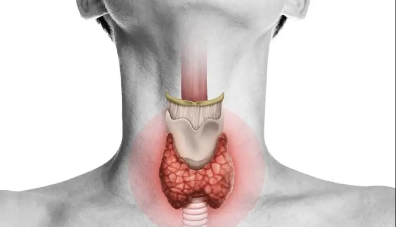 سرنخ‌های تیروئیدی!