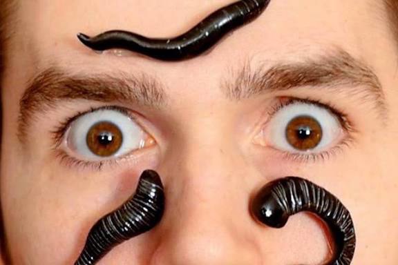 مراقبت های پس از زالو انداختن!