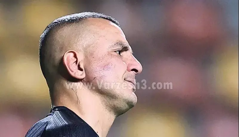 اخراج و تغییر چهره حامد لک برای برد