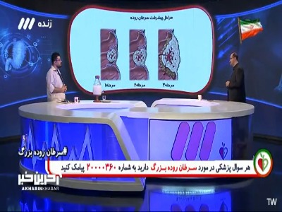 تاثیر تغذیه در ناراحتی‌های گوارش