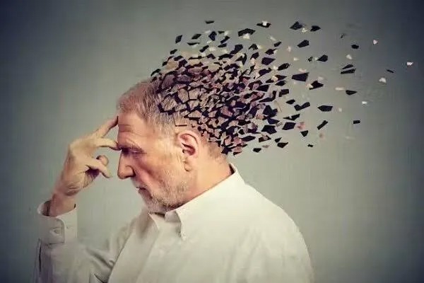 ارتباط داروهای پوکی استخوان با کاهش خطر زوال عقل